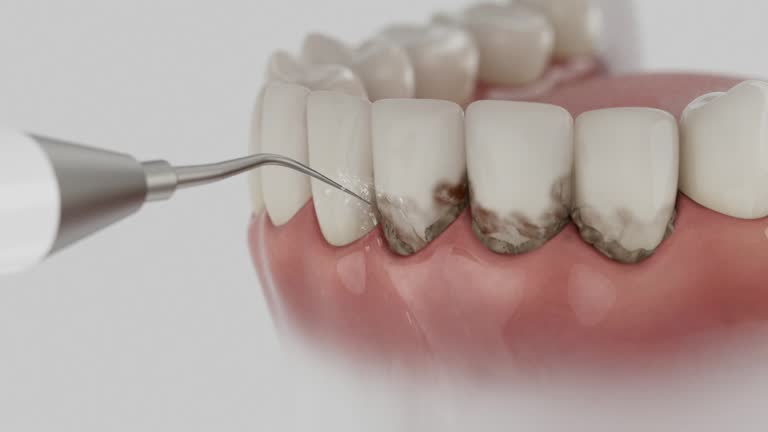 Reliable Dental Implants contractor in Arcadia, SC by Smile Center Dentistry